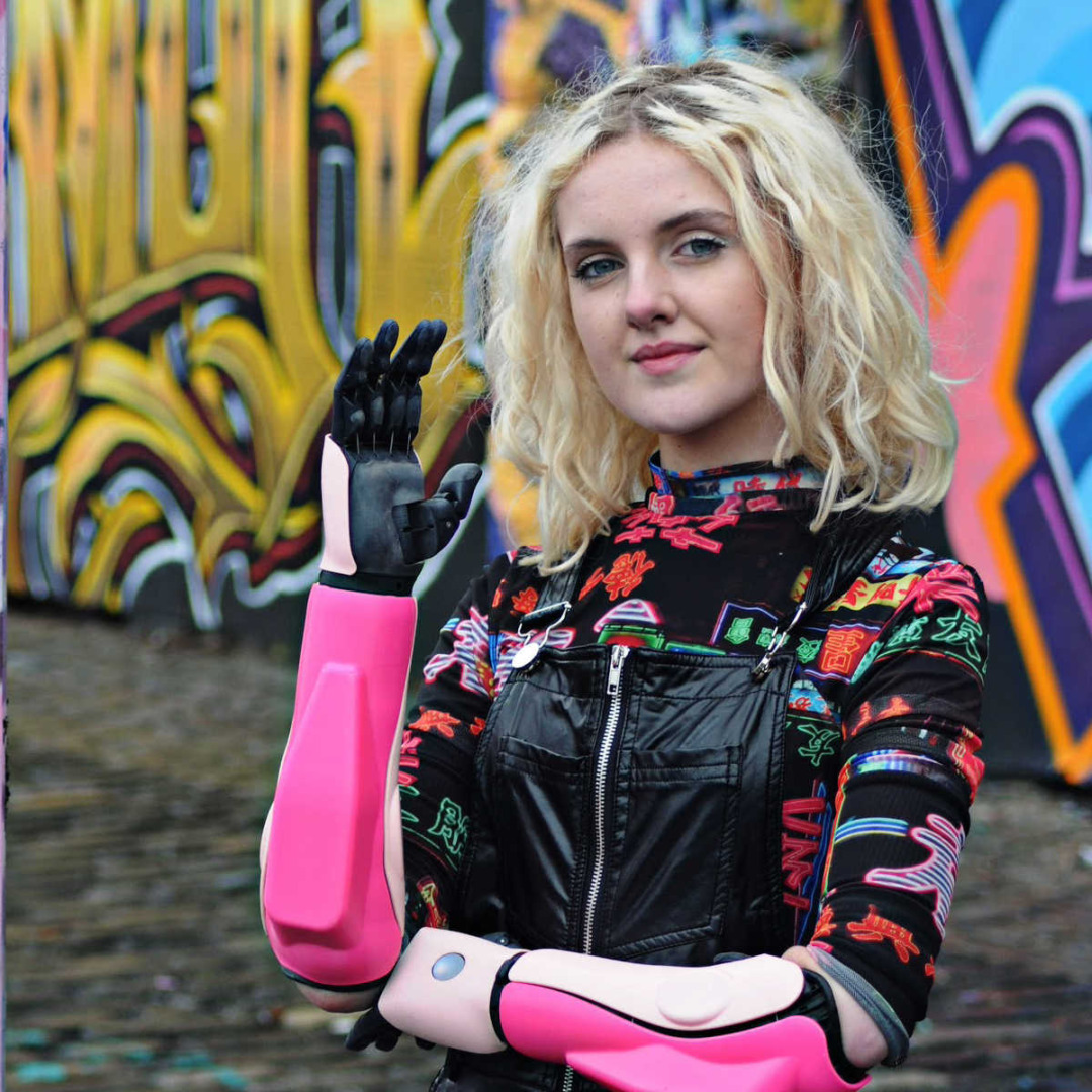 Tilly Lockey bionic arms